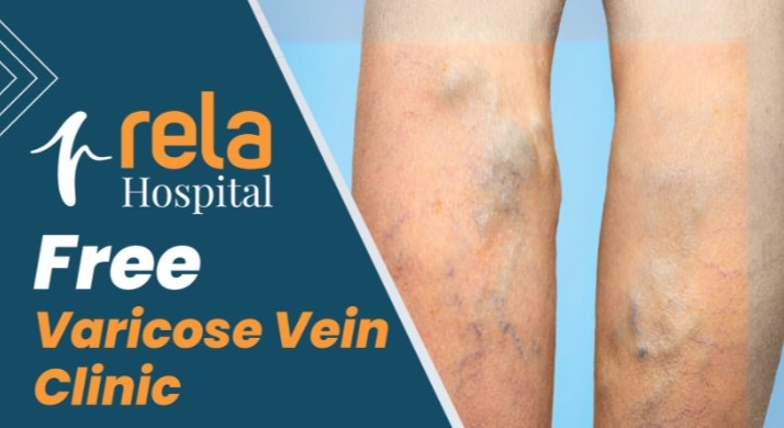 Rela Hospital Initiates Free Varicose Vein Clinic to Address Rising Cases of Chronic Leg Pain and Vein Disorders